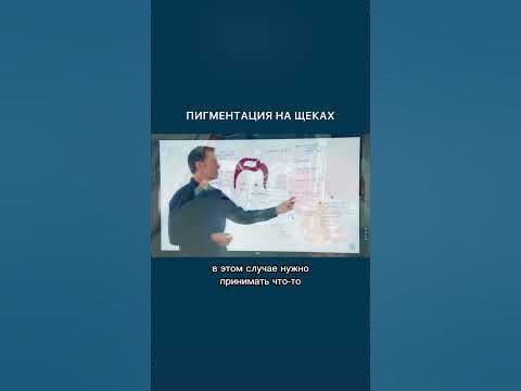 Пигментация на щеках 👉 причины и решение проблемы. - YouTube
