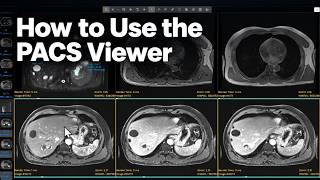 How to Use the PACS Viewer | Navigating Radiology Tutorial