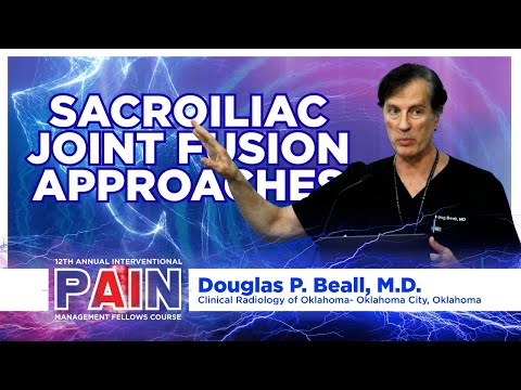 Sacroiliac Joint Fusion Approaches Douglas P Beall M D 
