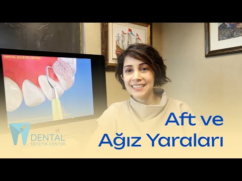 Sık Yaşanan Aft ve Ağız Yaraları Neyin Belirtisidir?