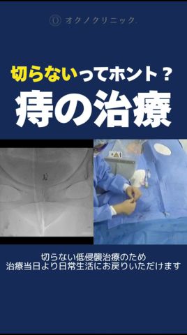 切らないってホント? 痔の治療