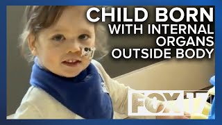 Toddler Born With Organs Outside His Body Continues To Push Boundaries