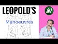 Leopold's Manoeuvres