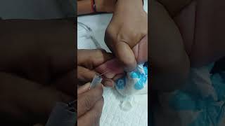 blood sampleing 🐥#cute #baby