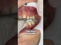 Ref:VBHeHKSF0GQ Dentes sens�veis  #odontologia #dentista #sensibilidade