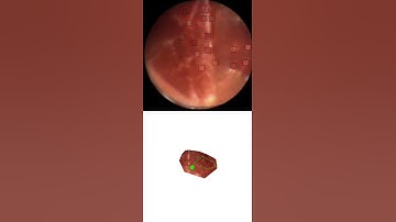 FIbroscopic Simultaneous Localization And Mapping (SLAM) for Minimally Invasive Surgery - Ex vivo