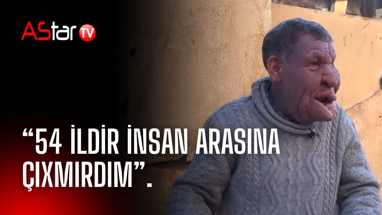 “Biri mənə dedi: bu insandır, yoxsa heyvandır?”