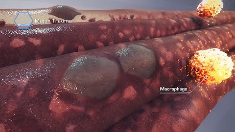 Muscle Regeneration