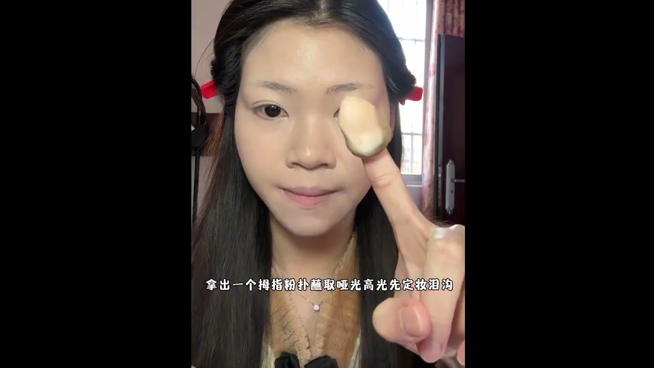 Princess with severe dark circles and tear troughs please come in Everyone ignore my nose