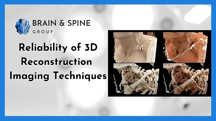 Reliability of 3D Reconstruction Imaging Techniques