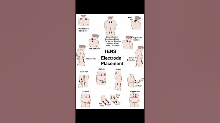 #physiotherapy #TENS         How, when, and where to use the TENS machine !
