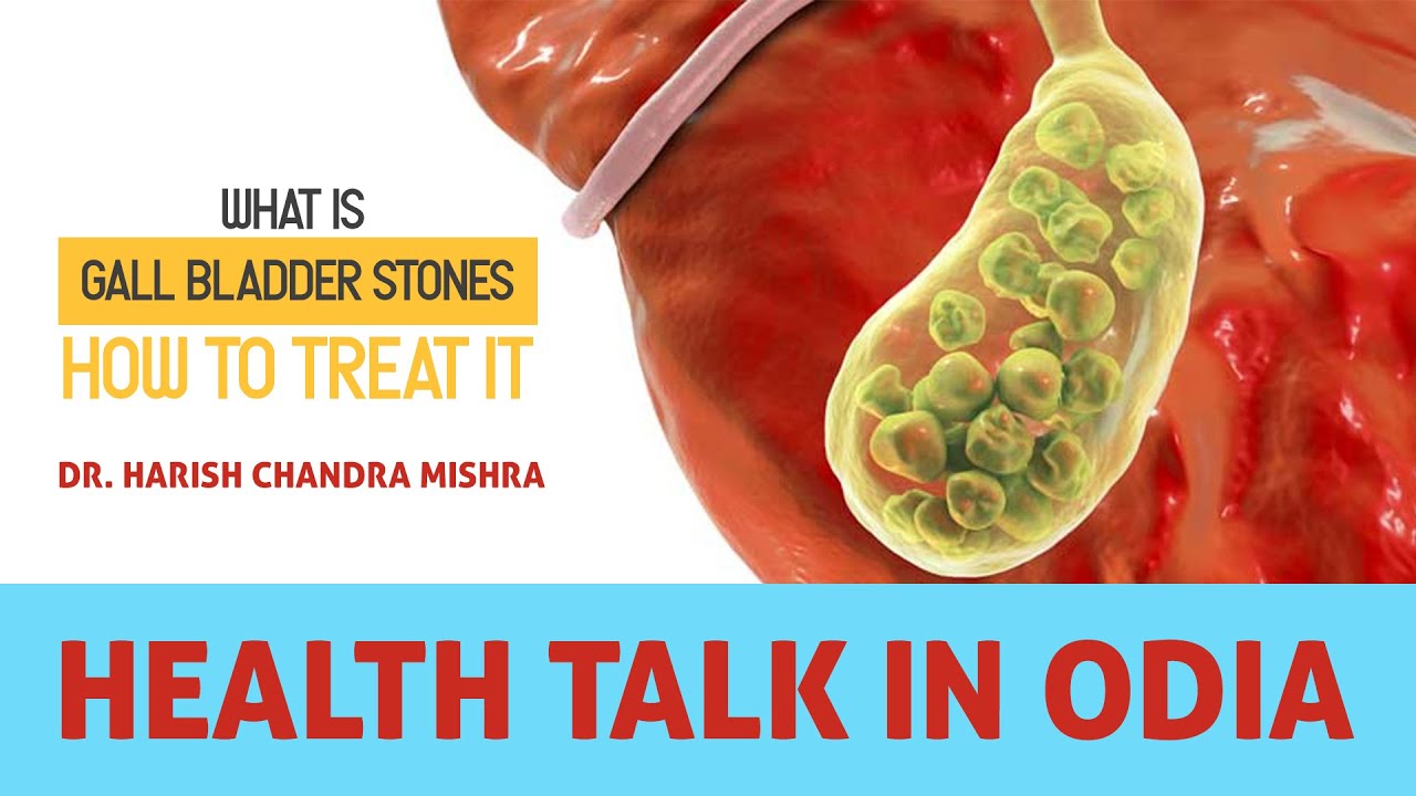 What is Gall Bladder Stones and How to treat it? || Dr Harish Chandra Mishra || LIGG HOSPITAL