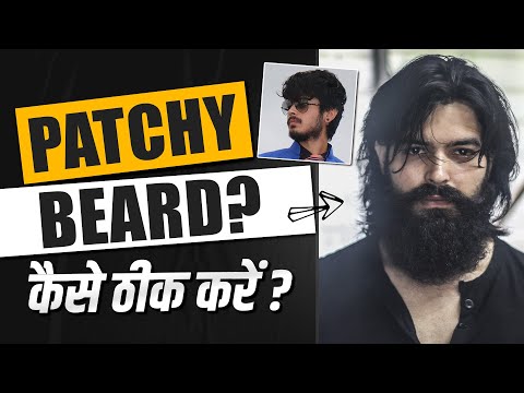 PATCHY BEARD? 100% natural SOLUTION | How to Grow beard | beard growth tips | Beard Growth Secret