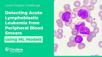 Acute Lymphoblastic Leukemia (ALL) Detection Using Deep Learning Models from PBS Images