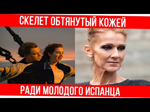 Video: Celine Dion mwembamba alianza kuonekana mzee kuliko miaka yake