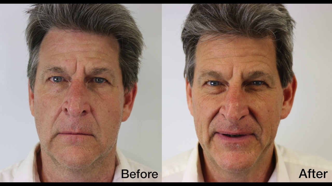 Natural Healing Cancer with Colonics: Rob's Full Story