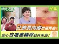 黑痣病變潰爛 當心皮膚癌轉移致死率高！指甲長詭異黑線是疾病警訊！肚臍滲液長肉瘤恐罹胃癌！蟹足腫傷口沒癒合恐癌變！活到106歲不長斑 解密美齡粥！ 健康2.0 20220521(完整版)