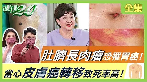 黑痣病變潰爛 當心皮膚癌轉移致死率高！指甲長詭異黑線是疾病警訊！肚臍滲液長肉瘤恐罹胃癌！蟹足腫傷口沒癒合恐癌變！活到106歲不長斑 解密美齡粥！ 健康2.0 20220521(完整版) - 天天要聞