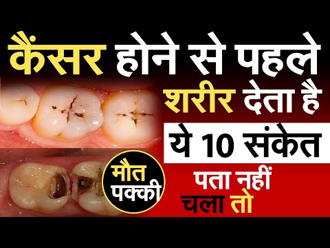 कैंसर होने से पहले शरीर देता है ये 10 संकेत पता नहीं चला तो घातक | देख लें कहीं देर ना हो जाए R1