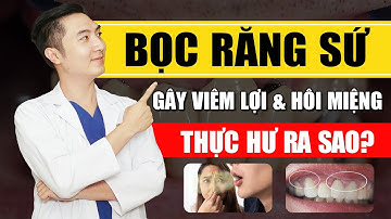 Bọc Răng Sứ Gây Viêm Lợi Và Hội Miệng - Thực Hư Ra Sao? | Nam Bùi Vinalign
