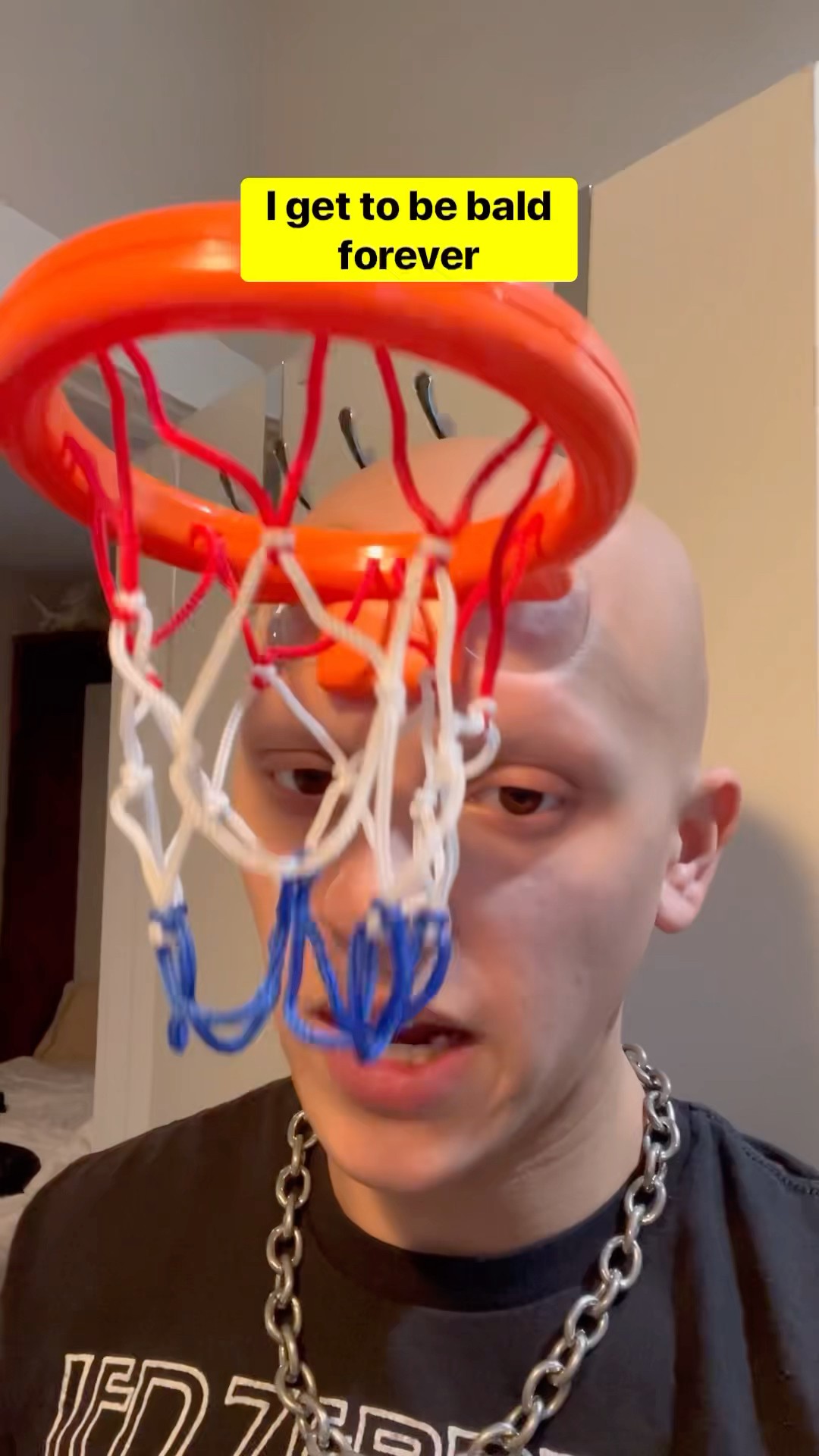 NOOO? #comedy #funny #alopecia