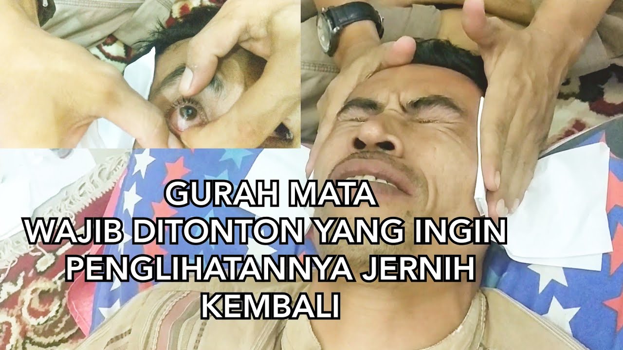 gurah-mata-adalah-obat-mata-paling-ampuh-untuk-menyembuhkan-sakit-mata