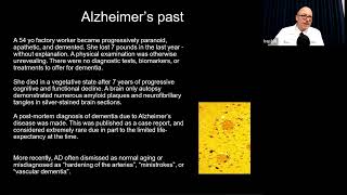 New Disease-Modifying Treatments for Individuals with Early Alzheimer’s Disease: Risks and Benefits