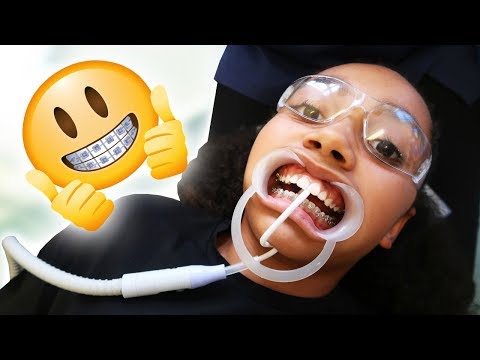 TIANA GETS BRACES!! She Was Scared