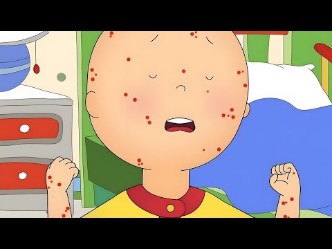 Oh No! Chickenpox! | Caillou Compilations