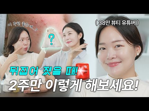 🆘응급 스킨케어 루틴! 피부 갑자기 뒤집어졌을 때 2주만 이렇게 하세요! | 디어 마이 프렌즈 아기자기 장벽루틴편 - video from Demaf