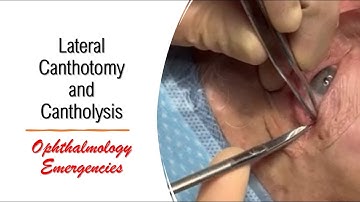 Lateral Canthotomy and Cantholysis