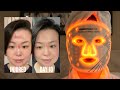 私を顔面負傷から救ってくれたLEDマスクが凄過ぎた | CurrentBody Skin LED Light Therapy Mask REVIEW