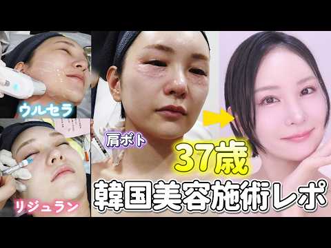 37-Year-Old’s Korean Beauty Procedure Report 🇰🇷 Ultherapy, Eye Rejuran, and Shoulder Botox: 1-Mon...