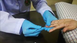 Dermal Puncture
