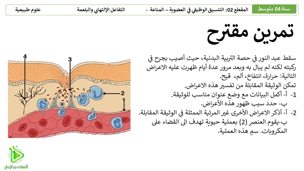 تمرين مقترح لشهادة التعليم المتوسط BEM - التفاعل الإلتهابي - البلعمة - علوم طبيعية سنة 04 متوسط