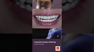 Ascent Before After Solihull