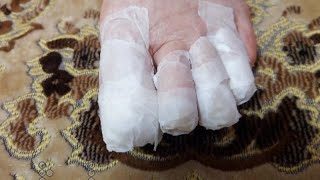 видео: ДЕМЕНЦИЯ :.срезаем ногти на ногах..могло быть и хуже..как жить с тем-у которого #деменция #мама #39s картинка: ДЕМЕНЦИЯ :.срезаем ногти на ногах..могло быть и хуже..как жить с тем-у которого #деменция #мама #39s