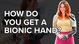 How To Get A Bionic Hand
