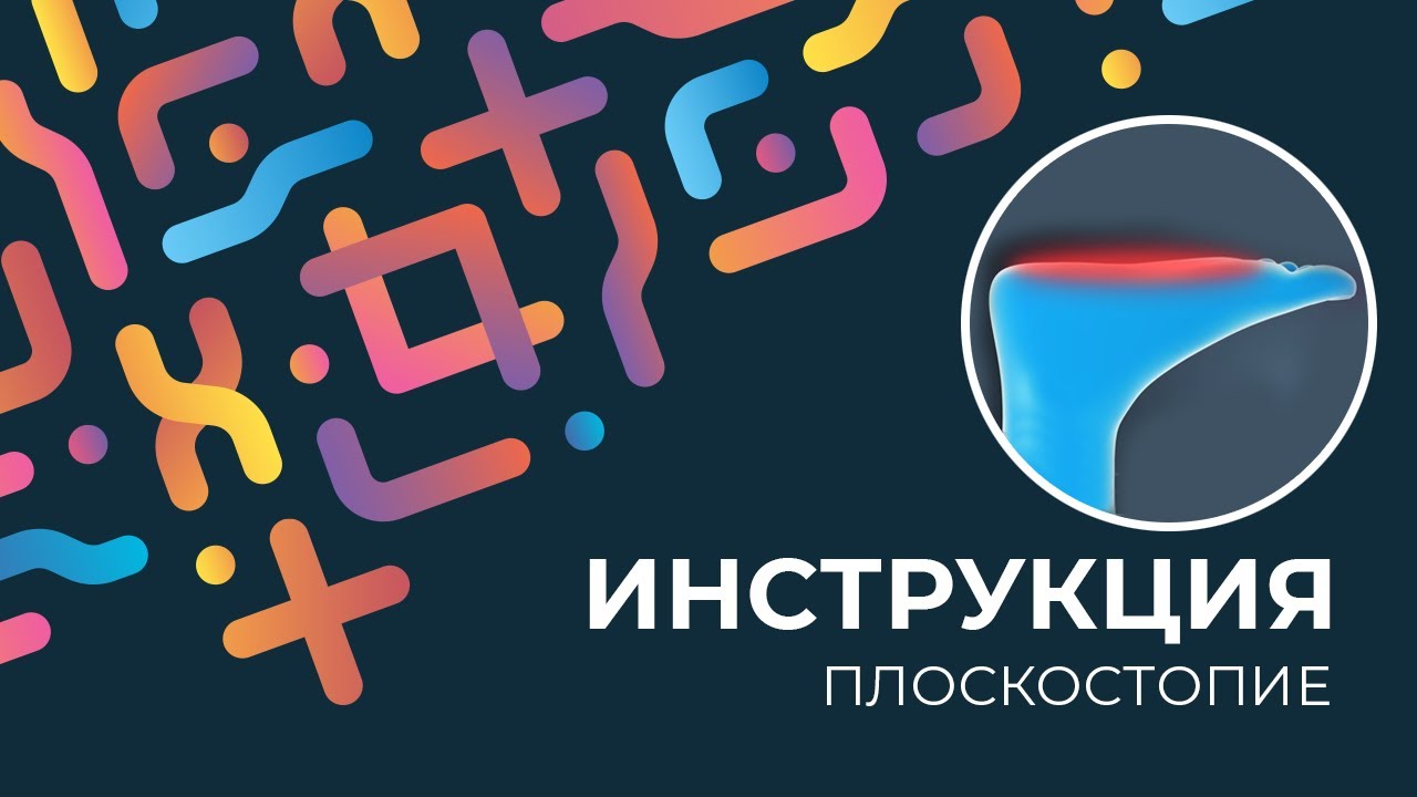 Kinexib - тейпирование плоскостопия