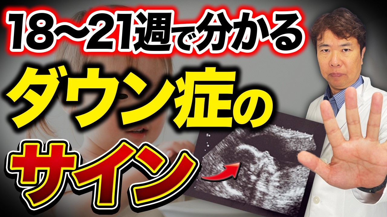 【高齢出産】胎児ドックでダウン症が分かる！？ 知るだけで不安が消えます