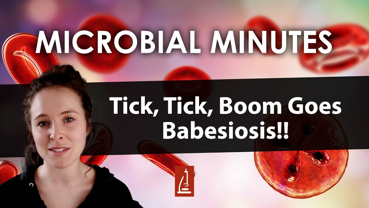 babesiosis-what-is-it-and-why-is-it-spreading-youtube