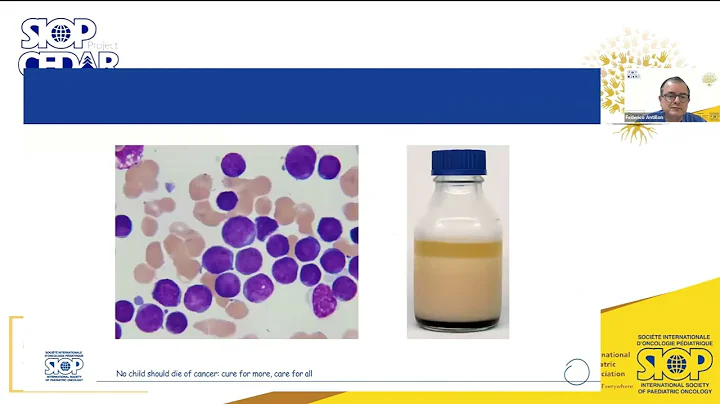CEDAR Webinar 2 "Diagnosis and Referral of Acute L...