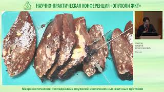 Макроскопическое исследование опухолей внепеченочных желчных протоков