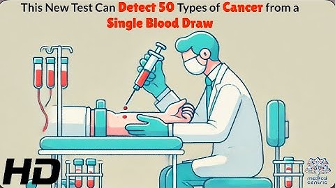 Revolutionary Test Detects 50 Types of Cancer Early!