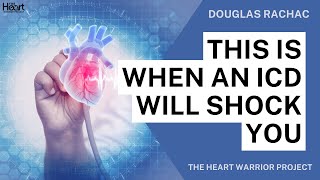 When an ICD Will Shock You | Myth vs. Truth with a Former Medtronic Employee
