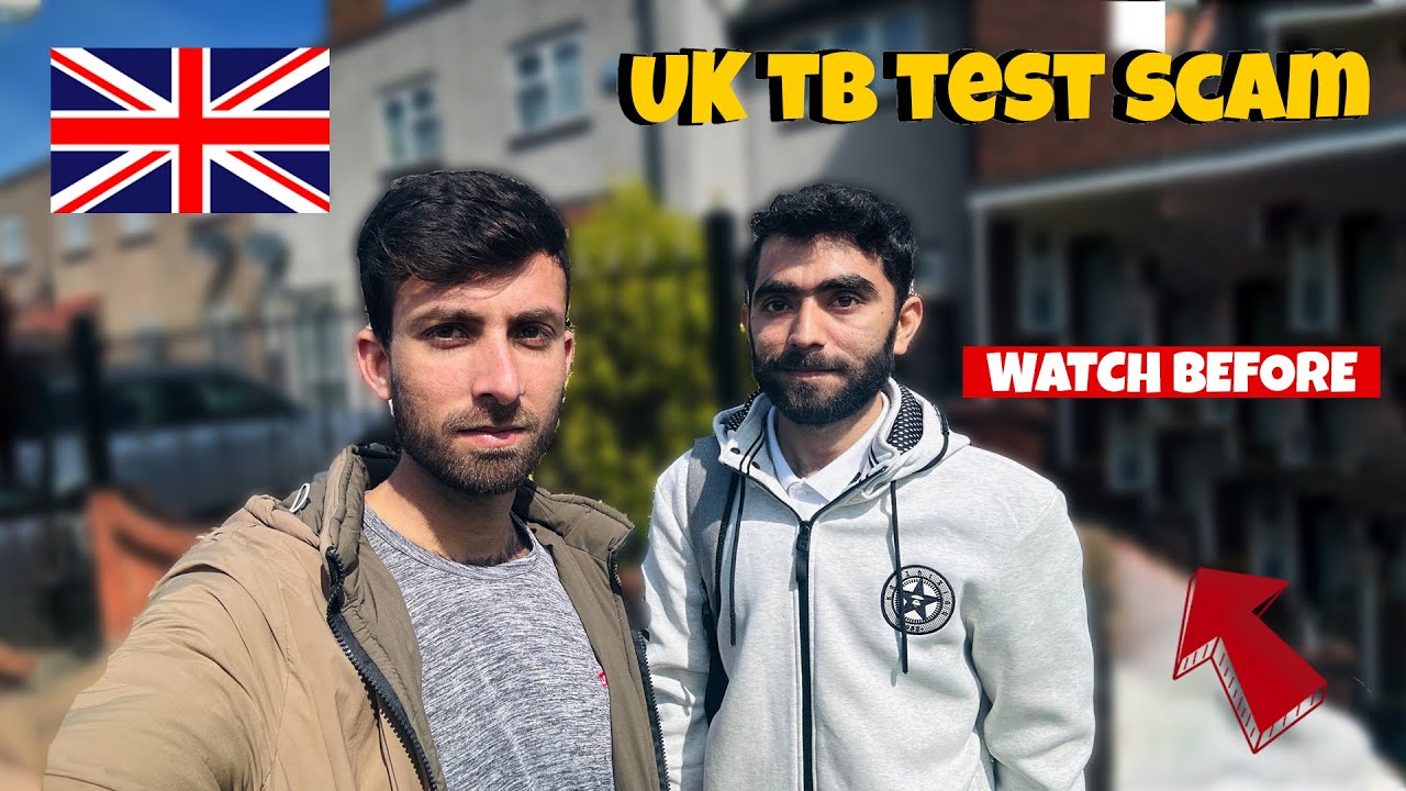 tb-test-for-uk-visa-all-you-need-to-know-about-tb-test-complete