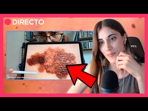 ¿Cuándo son PELIGROSOS los LUNARES de la PIEL? ft. Juan Gavín y Rilastil