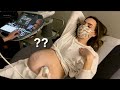 CARA HAD TO GET ANOTHER BABY ULTRASOUND!