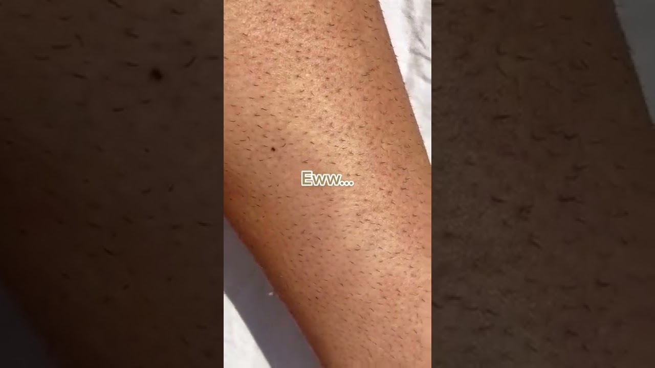 Get rid of your strawberry legs with Bleame Crystal Hair Eraser