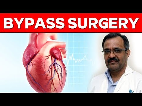 Special Interview With Best Heart Surgeon and Sr. Consultant Cardiac Surgeon Sanjay Agarwal